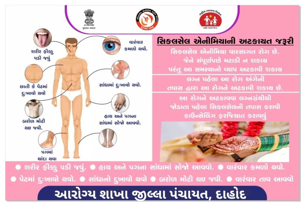 *૧૯મી જૂન ૨૦૨૫ વિશ્વ સિકલસેલ દિવસ* *દાહોદમાં વિશ્વ સિકલસેલ દિવસની ઉજવણી કરવામાં આવશે* 