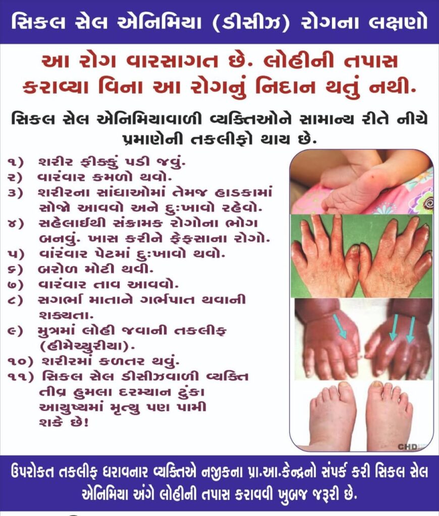 *૧૯મી જૂન ૨૦૨૫ વિશ્વ સિકલસેલ દિવસ* *દાહોદમાં વિશ્વ સિકલસેલ દિવસની ઉજવણી કરવામાં આવશે* 