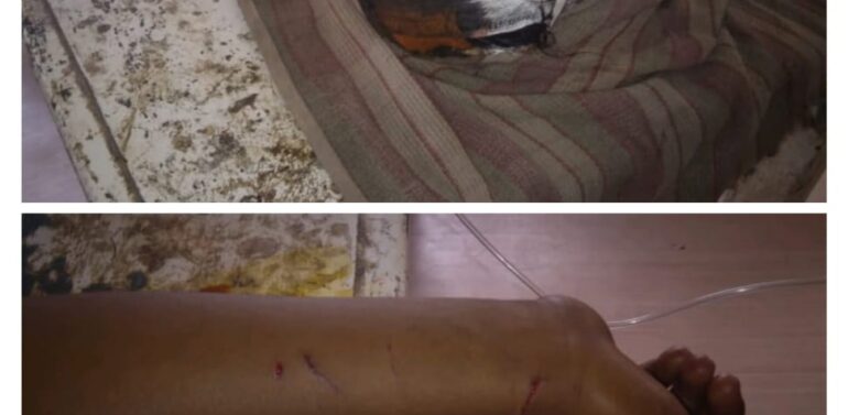  દે.બારીયા પંથકમાં દીપદાઓના હુમલાઓનો સિલસિલો અકબંધ:જંગલમાં લાકડા વીણવા ગયેલી 13 વર્ષીય બાળા પર દીપડાએ હુમલો કરતા લોહીલુહાણ:ઈજાગ્રસ્ત બાળકીને ગોધરા રીફર કરાઈ