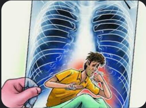  રેસ્ટ ઓફ ધ રેર તેમજ ખુબ જ ઘાતક અને જીવલેણ ગણાતી XDR TB નો પ્રથમ કેસ ઝાયડસ હોસ્પિટલમાં નોંધાયો